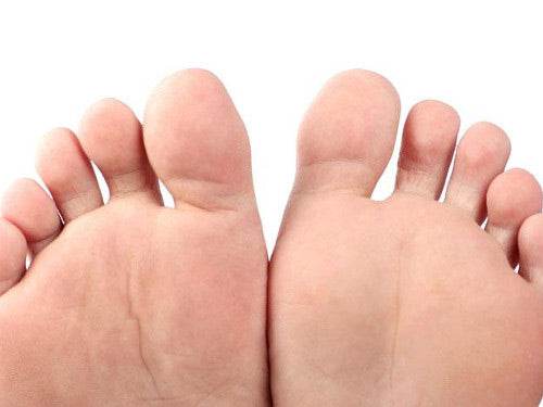 Natural, home remedies for gout - Health Nutrition
